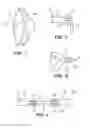 Fig. 02 - Eyeglasses