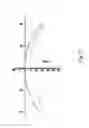 Fig. 08 - Method for determining an ophthalmic lens comprising an aspherical continuous layer on one of its faces and an aspherical Fresnel layer on one of its faces
