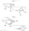 Fig. 22 - Rolling foot controller