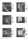 Fig. 02 - METHODS AND SYSTEMS FOR DIAGNOSING PRENATAL ABNORMALITIES