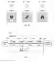 Fig. 06 - Image forming apparatus using filters to correct potential distribution on photoreceptor due to spot shape of emitted light