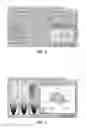 Fig. 06 - Systems and methods for earth-boring rotary drill bit selection