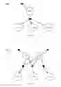 Fig. 09 - Multisensory speech detection