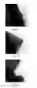 Fig. 09 - Method for manufacturing platinum nanoparticle solution and self-assembled platinum counter electrode thereof
