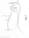 Fig. 02 - Hearing aid comprising a flexible connection member