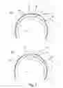 Fig. 08 - HEARING AID DEVICE