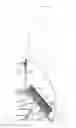 Fig. 01 - Force Transfer Harness and Method