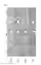 Fig. 06 - Method for maintaining organ or tissue for transplantation use for long period