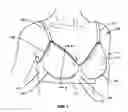 Fig. 02 - Upper and lower torso garments having an improved band