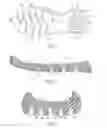 Fig. 02 - Sole assembly formed from multiple preforms and method and mold for manufacturing same
