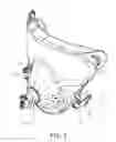 Fig. 02 - Buckle assembly and respiratory mask including the same