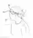 Fig. 01 - Hands-free medication holder headband and method of use