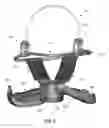 Fig. 03 - Repositionable Infant Support Structures