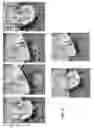 Fig. 16 - Repositionable Infant Support Structures