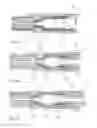 Fig. 06 - Disposable assembly, a system and method for preparing a foamed food product