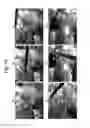 Fig. 07 - MULTI-VIEW IMAGING SYSTEM FOR LAPAROSCOPIC SURGERY