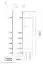 Fig. 03 - Apparatus for finding a functional tissue area in a tissue region