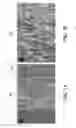 Fig. 07 - FABRICATION AND USE OF EPIDERMAL ELECTRODES