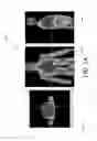 Fig. 07 - Multi-bed elastic motion correction