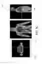 Fig. 09 - Multi-bed elastic motion correction