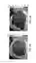 Fig. 12 - Systems and methods for mechanical mapping of cardiac rhythm