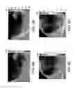 Fig. 13 - Systems and methods for mechanical mapping of cardiac rhythm