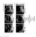 Fig. 34 - Systems and methods for mechanical mapping of cardiac rhythm