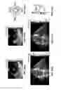 Fig. 35 - Systems and methods for mechanical mapping of cardiac rhythm