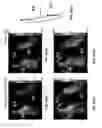 Fig. 37 - Systems and methods for mechanical mapping of cardiac rhythm