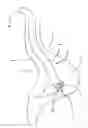 Fig. 01 - Endoscopes having multiple lumens for tissue acquisition and removal and related methods of use