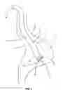 Fig. 02 - Endoscopes having multiple lumens for tissue acquisition and removal and related methods of use