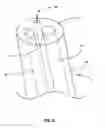 Fig. 03 - Endoscopes having multiple lumens for tissue acquisition and removal and related methods of use