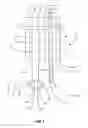 Fig. 04 - Endoscopes having multiple lumens for tissue acquisition and removal and related methods of use