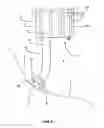 Fig. 09 - Endoscopes having multiple lumens for tissue acquisition and removal and related methods of use