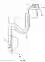 Fig. 13 - Endoscopes having multiple lumens for tissue acquisition and removal and related methods of use