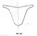 Fig. 10 - Specimen retrieval device with pouch stop