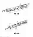 Fig. 17 - Specimen retrieval device with pouch stop