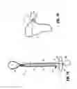 Fig. 23 - Specimen retrieval device with pouch stop