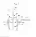 Fig. 07 - Tissue retractor apparatus and methods