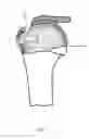 Fig. 08 - Arthroscopic Method and Apparatus for Rotator Cuff Repair