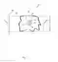 Fig. 12 - Arthroscopic Method and Apparatus for Rotator Cuff Repair