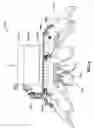Fig. 07 - ENGAGEMENT DEVICE AND METHOD FOR DEPLOYMENT OF ANASTOMOTIC CLIPS