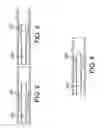 Fig. 03 - Single access flow-reversal catheter devices and methods