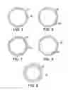 Fig. 04 - Single access flow-reversal catheter devices and methods