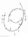 Fig. 06 - Single access flow-reversal catheter devices and methods