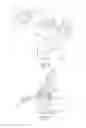 Fig. 06 - Natural alignment knee instruments