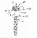 Fig. 01 - Screw element for use in spinal, orthopedic or trauma surgery and a system of such a screw element and a screw driver adapted thereto