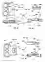 Fig. 10 - Spine stabilization