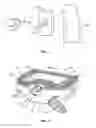 Fig. 02 - Implant with an interference fit fastener