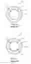 Fig. 03 - Arch shaped laser catheter